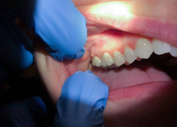  St Matthews, SC Emergency Dentist Pros